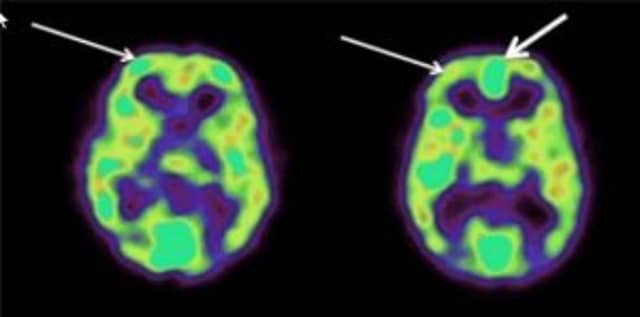 well-being-scan