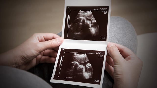 The Miscarried Fetus in Islam: Meeting Your Lost Child in Jannah | Blog